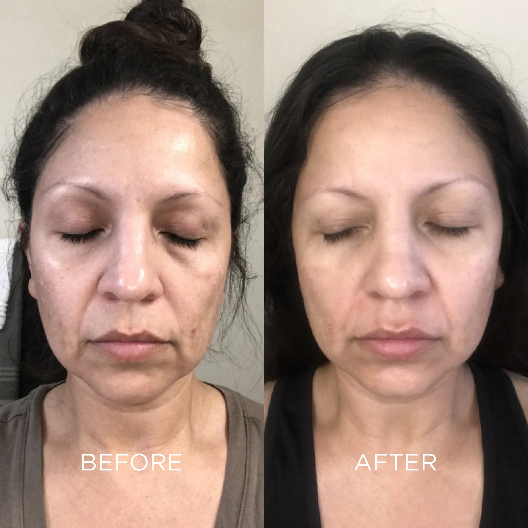 4-in-1 Instant Results Kit - Image 3