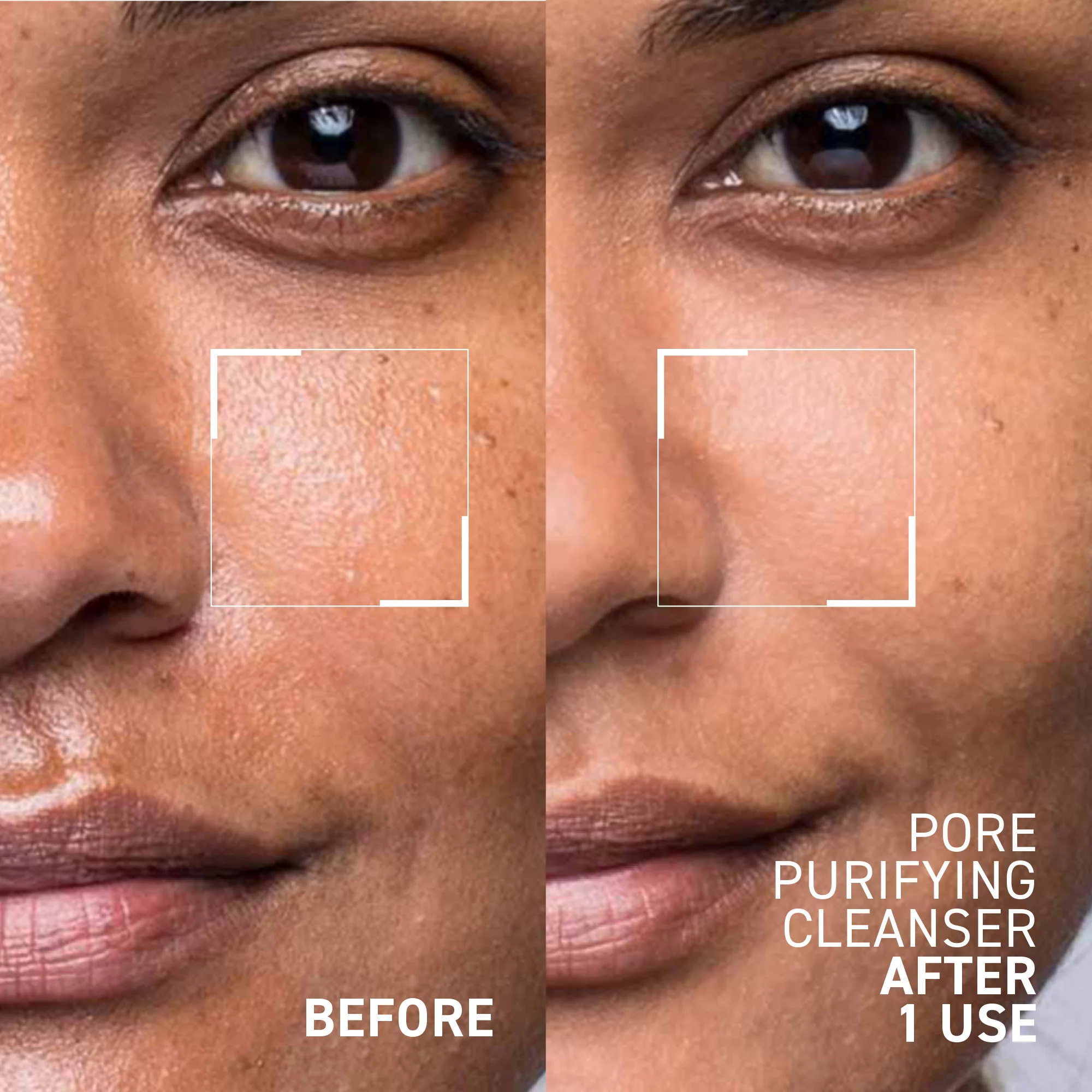 4-in-1 Instant Results Kit - Image 6