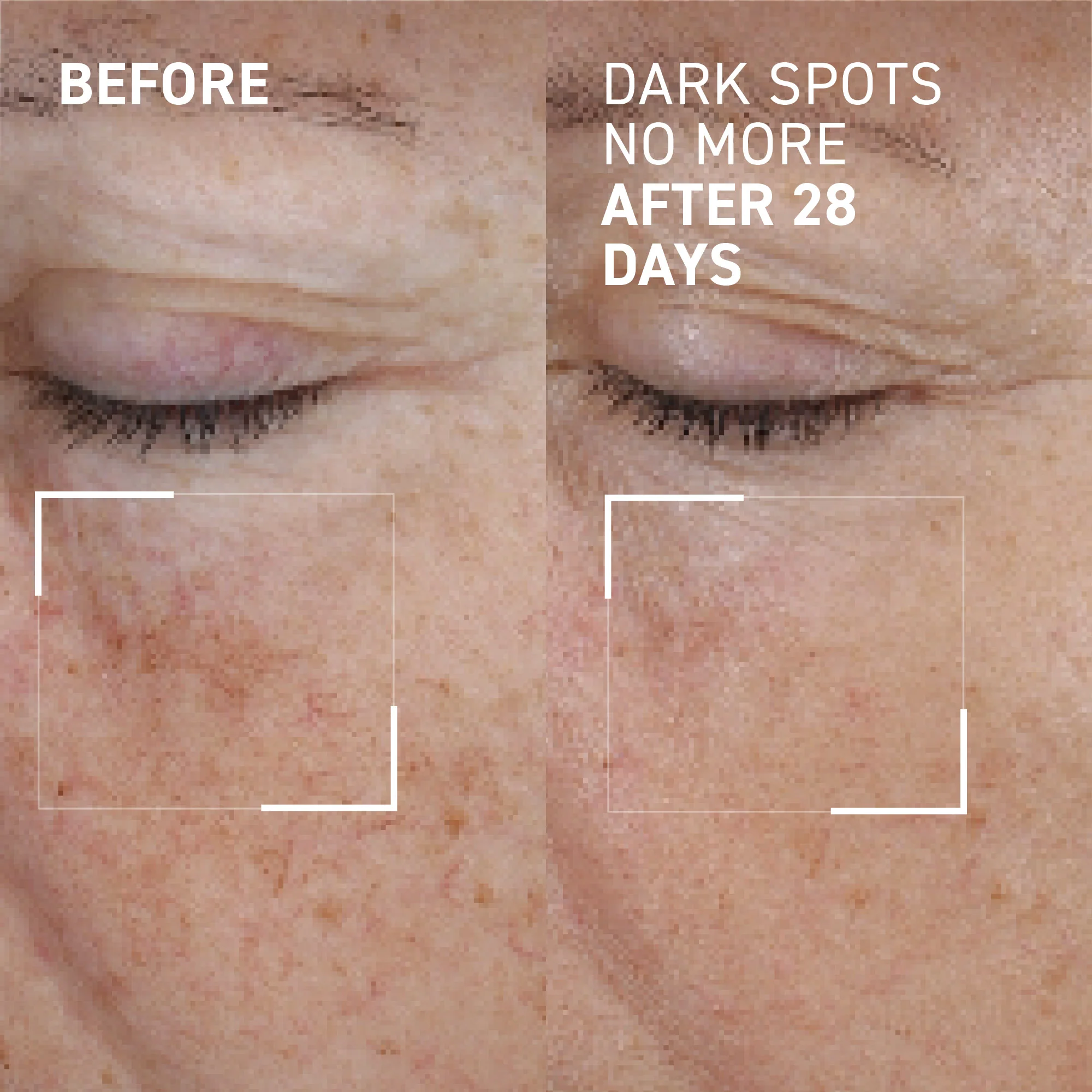 Dark Spots No More® - Image 3
