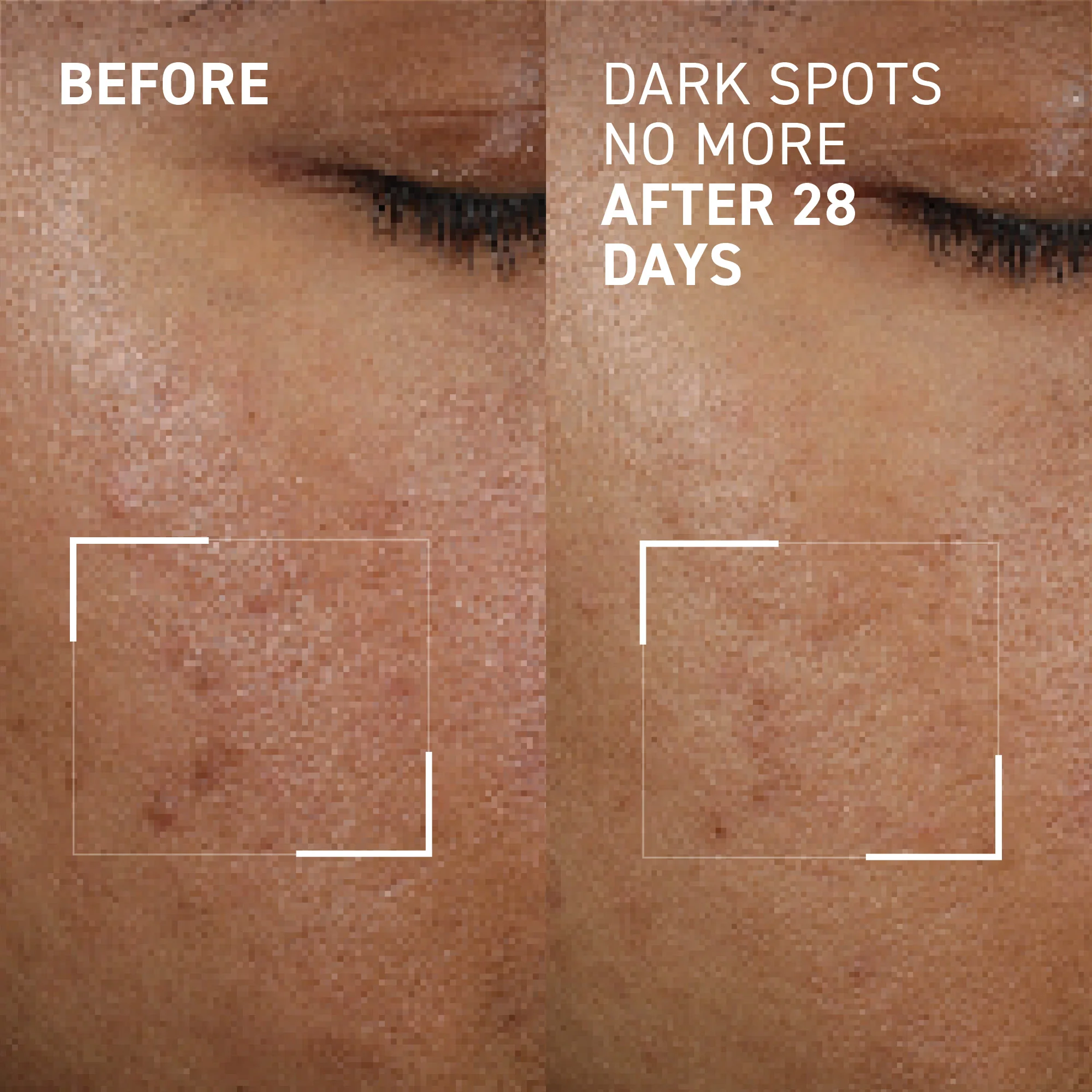 Dark Spots No More® - Image 4