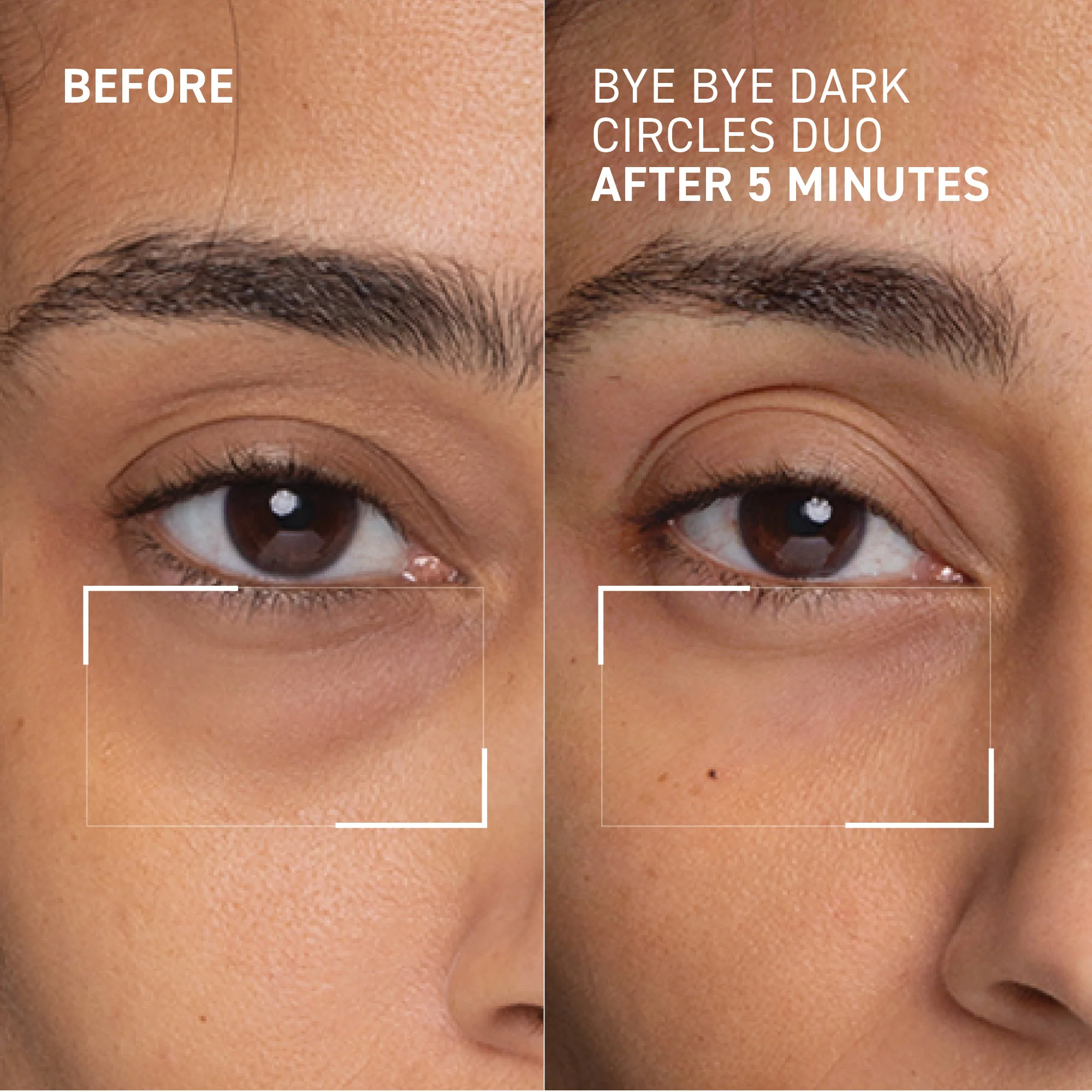Dark Circles Correcting Eye Duo - Image 2