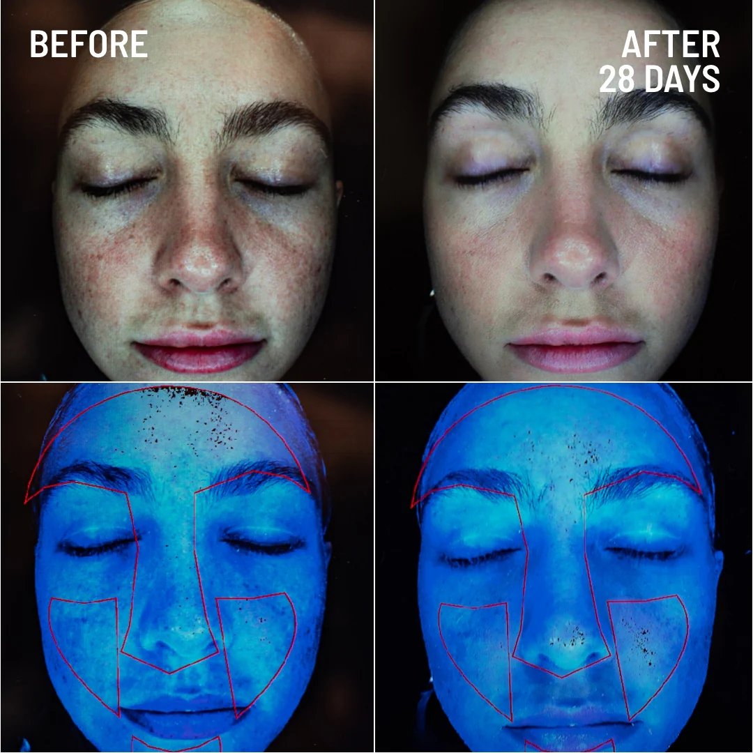 Gentle Microdermabrasion Face Exfoliator - Image 3
