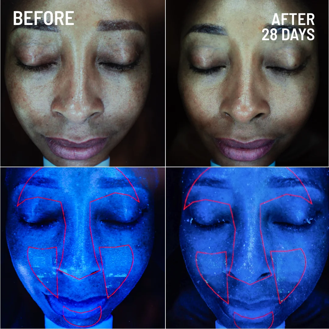 Gentle Microdermabrasion Face Exfoliator - Image 5