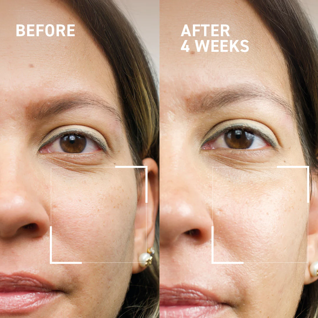 Microneedling Renewing Duo - Image 3