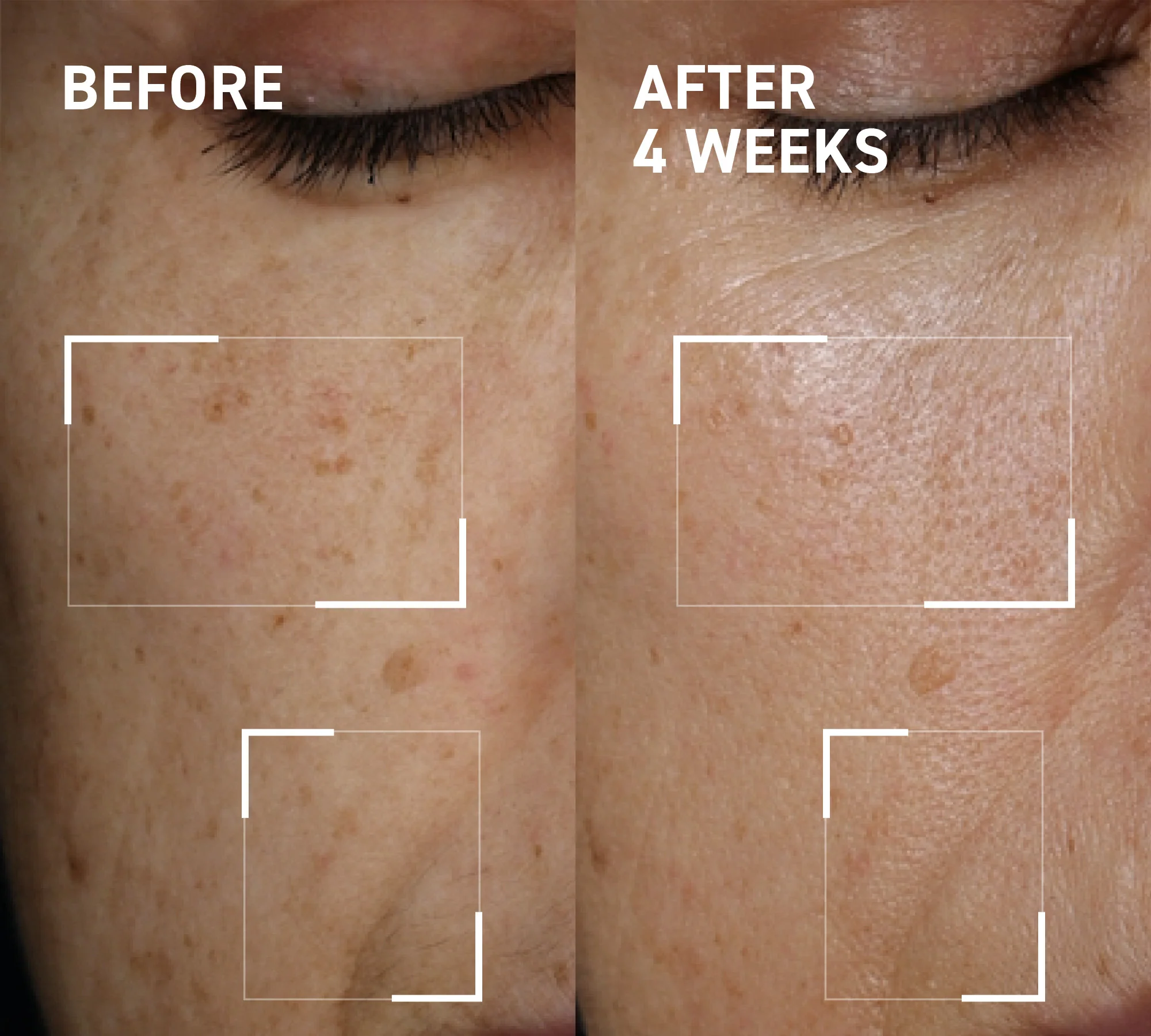 Microneedling Glow Duo - Image 3