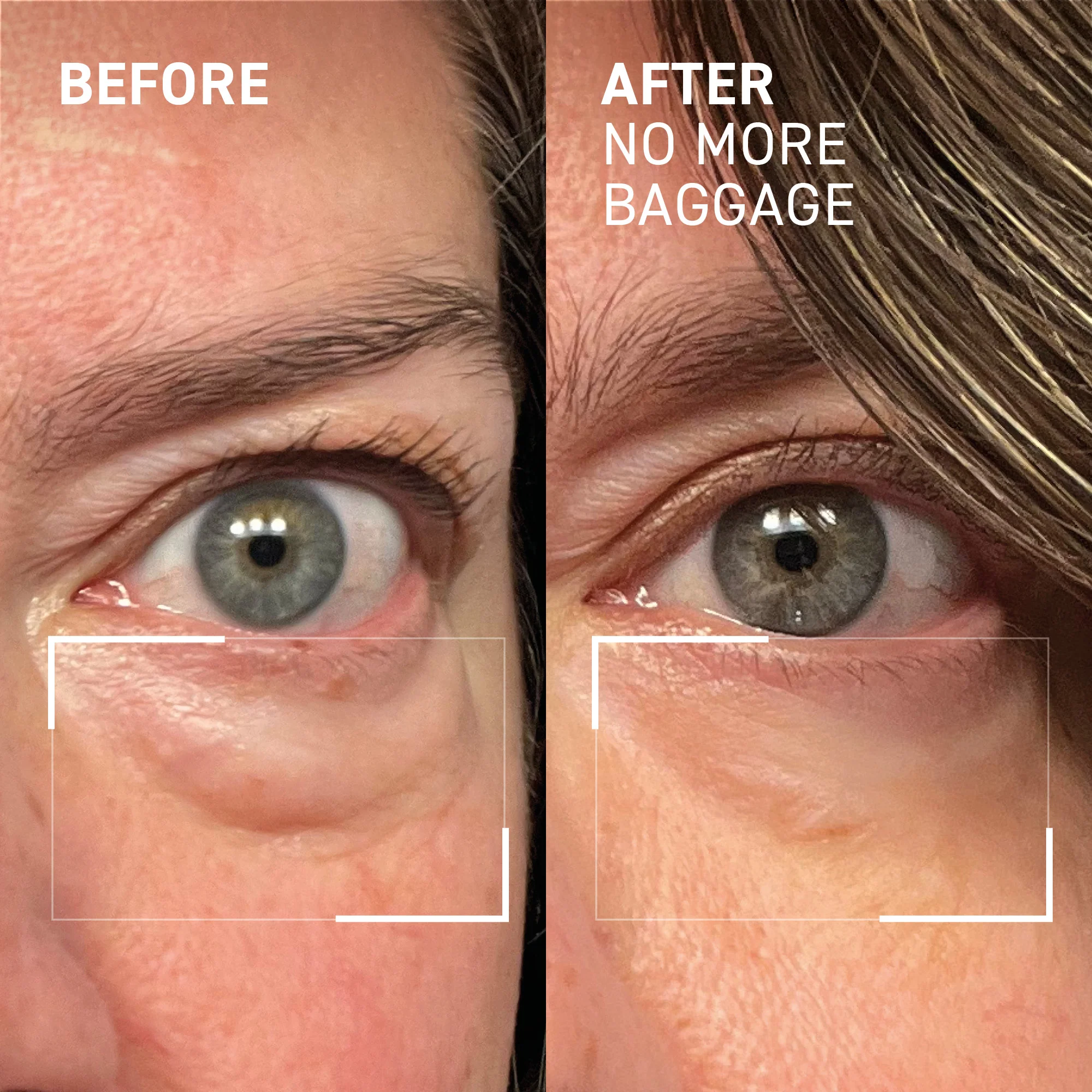 NO MORE BAGGAGE - Image 8
