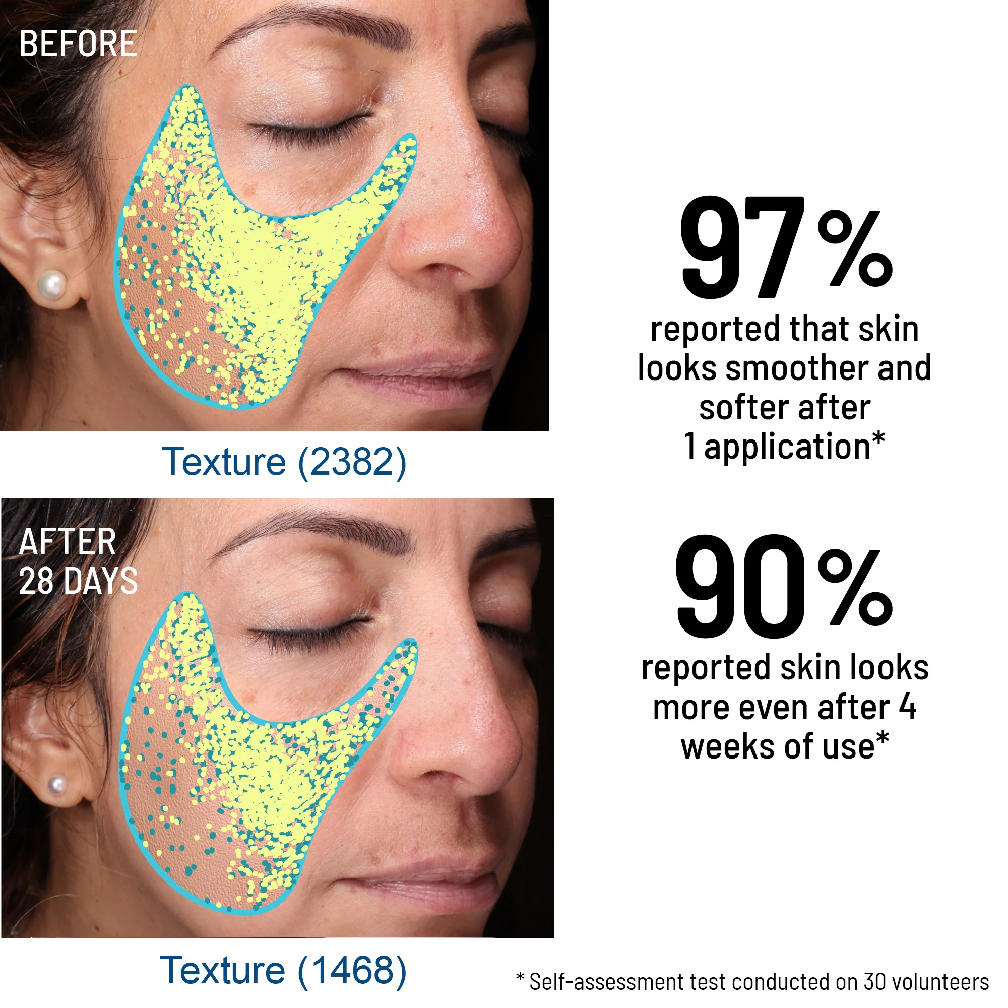Oxygen Facial Duo - Image 7
