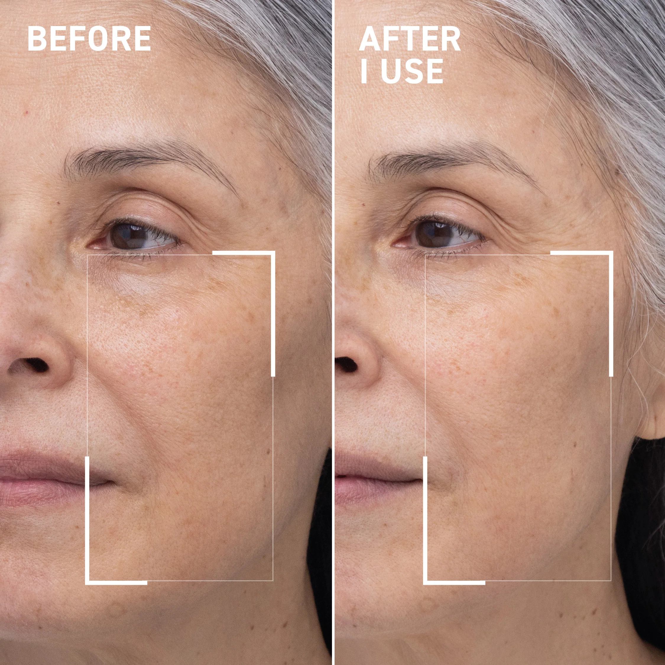Oxygen Facial Mask - Image 5