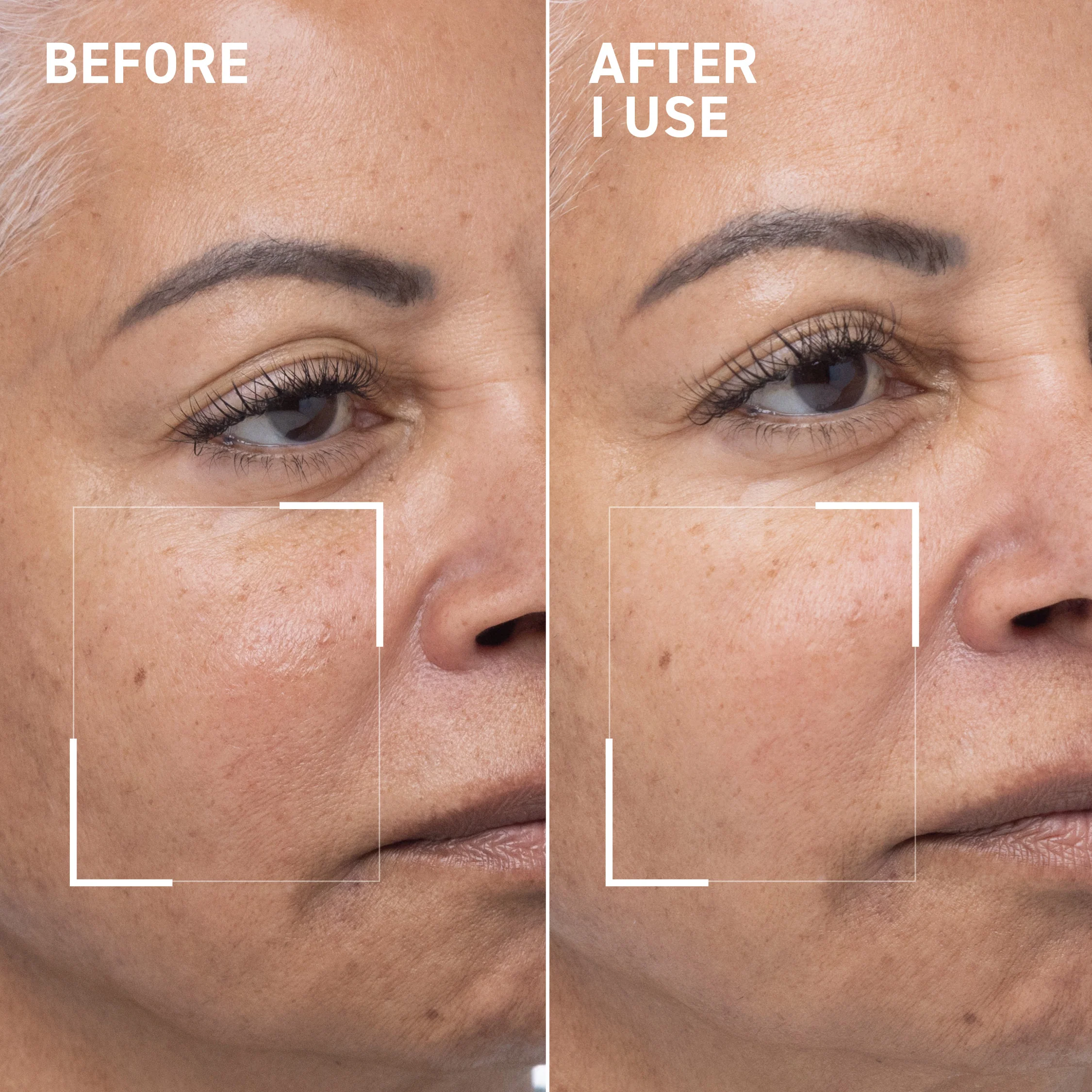 Oxygen Facial Mask - Image 6