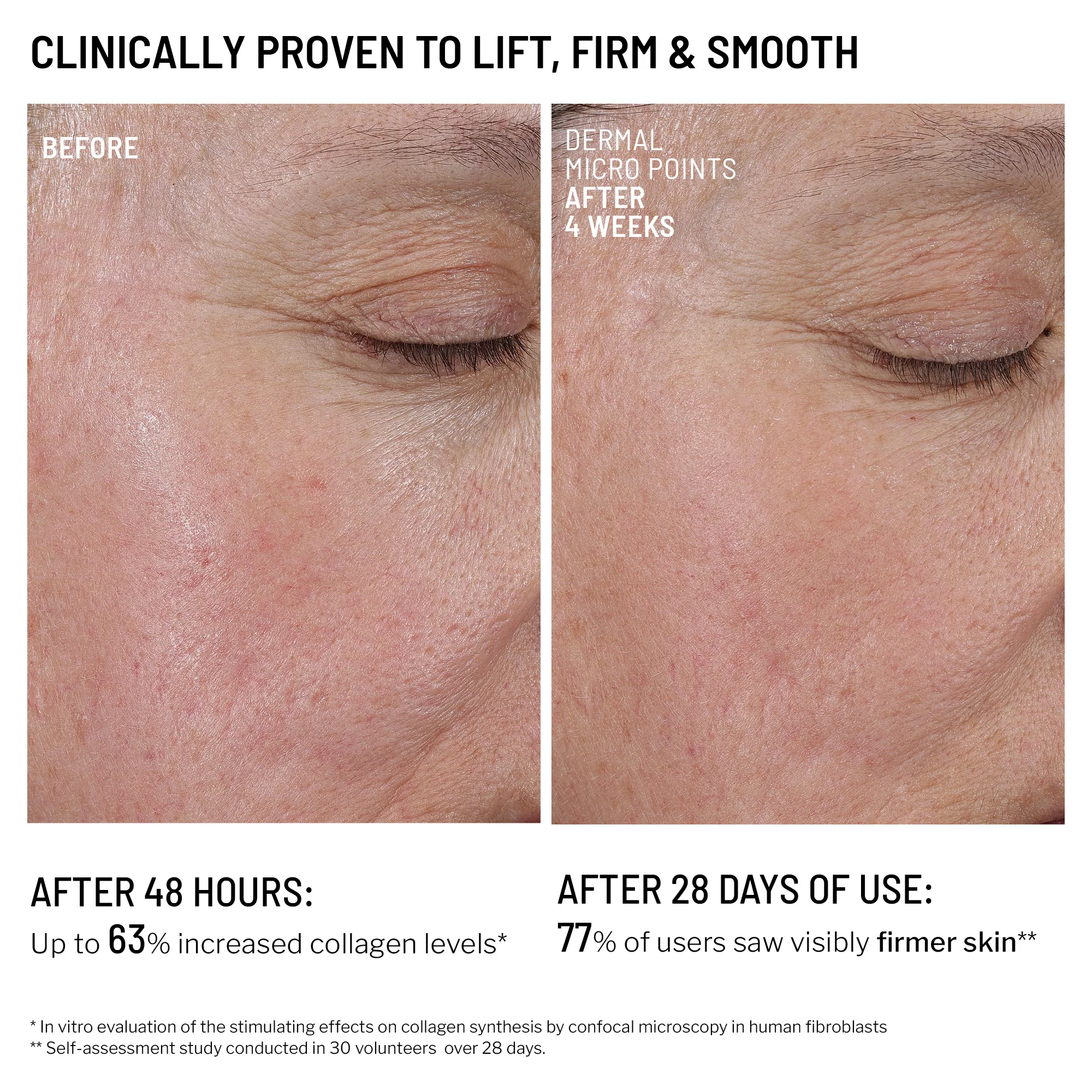 Microneedling Recovery Duo - Image 7
